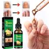 Ginger Nail Treatment Nail Support Nail Care, 7days Nail Treatment, Ginger Nail Growth Serum, Ginger Cuticle Care Oil for Nails,Cuticle Serum for Nails (2Pcs, 1 Fl.oz(pack of 1)) view 3