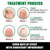 Ginger Nail Treatment Nail Support Nail Care, 7days Nail Treatment, Ginger Nail Growth Serum, Ginger Cuticle Care Oil for Nails,Cuticle Serum for Nails (2Pcs, 1 Fl.oz(pack of 1)) view 4