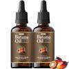 VIMOZA Batana Oil for Hair,Hair Oil with Rosemary for Hair Growth - 100% Organic Batana Oil (2pcs) view 1
