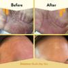 ECZEMA HONEY Brown Sugar Face & Body Scrub & Oatmeal Facial Cleanser  Soothes Eczema, Prevents Breakouts, & Nourishes Skin - Natural & Gentle Exfoliating Scrub & Face Wash for Dry, Itchy Skin view 4