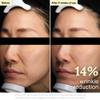 Rothea Resilience Cream, Anti-Aging with Bakuchiol 10,000ppm (Natural Retinol Alternative), Face Moisturizer, Neck Cream with Collagen, Ceramides, Peptides, Niacinamide, Korean Skin Care, 1.7 oz view 4