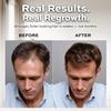 Reforian Castor Oil Shampoo and Conditioner for Hair Growth & Strength  2 in 1 Shampoo and Conditioner Set for Men & Women  Sulfate-Free Formula for Thinning, Dry or Color-Treated Hair, 8oz view 4