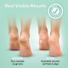 Lavinso Urea Cream 40 Percent for Feet with Maximum Strength - Foot Cream for Calluses and Dry Cracked Heels - Rough Skin Repair for Men and Women view 3