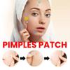 Pimples Patch, 200 Pieces of Cloud shape, Gently Absorbs in 4-7 Hours, Hydrocolloid, Non-Drying, Facial Sticker, Blemishes, Zits Absorbing Patch, Breakouts Spot Treatment for Skin Care view 2