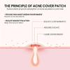 Pimples Patch, 200 Pieces of Cloud shape, Gently Absorbs in 4-7 Hours, Hydrocolloid, Non-Drying, Facial Sticker, Blemishes, Zits Absorbing Patch, Breakouts Spot Treatment for Skin Care view 4