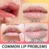 Strawberry and Orange Flavour Lip Scrubs Set,2 Pack Hydrating Lip Scrubber Exfoliator,Lip Moisturizer Care Product for Chapped Dry Dark Lips view 4