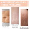 Silicone Patches for Stretch Marks, Anti Wrinkle Stretch Removal Sheet for Pregnant Women, Washable Reusable Skin Lifting & Tightening Silicone Tummy Sticker Belly Stickers Stretch Marks Pad (1pc) view 3