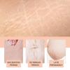 Silicone Patches for Stretch Marks, Anti Wrinkle Stretch Removal Sheet for Pregnant Women, Washable Reusable Skin Lifting & Tightening Silicone Tummy Sticker Belly Stickers Stretch Marks Pad (1pc) view 4