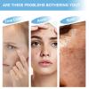 10% Niacinamide Serum + 1% Zinc - For Acne, Pore Minimizing & Shine Control - Daily Brightening Facial Serum - Non-Comedogenic, For All Skin Types, 1 Fl Oz view 3