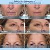 Plexa derm Rapid Reduction Wrinkle Serum - Reduces Under-Eye Bags, Wrinkles, Dark Circles, Fine Lines & Crow's Feet Instantly (2-Pack) view 4