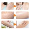 Electric Hair Removal Epilator Rechargeable Hair Trimmer Detachable Head Women Man (Purple) view 4
