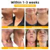 AEEHFENG Ultra Firming & Revitalizing CreamAdvanced New Skin Firming Cream, Body Lotion Moisturizer, Face Lotion & Body Cream-Renew Skin Firmness for All Skin Types (3Bottles, 60ml) view 2