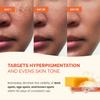 PLANTIFIQUE Kojic Acid & Turmeric Soap for Dark Spots & Hyperpigmentation view 4