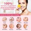akareni 80Pcs Turmeric Kojic Acid Cleansing Pads, Kojic Acid Turmeric Cleansing Pads for Face Dark Spots, Cleanser and Exfoliation, Helps Balance Skin Oil view 2