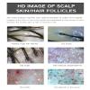 Miasazyr 11 Inch Skin Analyzer Machine Professional Scalp Detector Hair Follicles Oil Moisture Tester Digital Hair Microscope Facial Skin Scalp Analysis Machine 50X-200X view 4