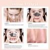 Kivori Nose Pore Patches,Hydrocolloid Acne Patches,Kivori Nose Patch, Nose Pore Patches,Nose Strips Blackhead Remover,Hydrocolloid Nose Strips,Pore Minimizer for Face (6 PCS) view 4