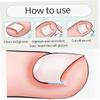 10PCS Ingrown Toenail Corrector Strips Foot Corrector Straightener Clip Curved Bs Brace Toenails Thick Correction Foot Tool view 4