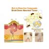 Bee Venom Cream, 2025 New Bee Venom Marks Spots Removal Treatment Cream for All Skin Types (1) view 3
