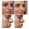 3pcs Nose Up Lifting Clips Nose Bridge Slimming Enhancer Silicone Nose Straightening Clip view 2