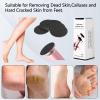 60 Pcs Replaceable Sandpaper Refill Discs for Electric Foot File Callus Remover Foot Care Dead Skin Cracked Hard Skin Removal - Coarse 80 Grit view 4