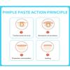 Acne Patchs, Miracle Invisible Hydrocolloid Acne Patch, Concealer Transparent Acne Removal, Used for the Entire Face, Back, Neck, and Chest2 Sizes (36 Pieces) view 4