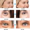 GUOYAOLIFU Under Eye Patch for Dark Circles and Puffy Eyes,Under Eye Masks Reduce Smooth Wrinkles and Under-eye Egg,Moisturizing Under Eye Pads For Women,Seaweed Eye Mask Patch-60 Pcs view 4