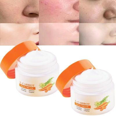 2PCS Crema de zanahoria para las manchas, Crema zanahoria para las manchas, 30G zanahoria cream for Face & Body, Face Moisturizer Cream