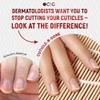 Cuticle-B-Gone Nail Care & Cuticle Remover Tool with Interchangeable Attachments, At Home or Travel Ready, Gentle Cuticle & Hangnail Grooming for Finger Nails & Toe Nails view 4