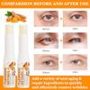 2PCS Turmeric Retinol Eye Stick,Lumibalm for Under Eyes Bags,Eye Balm Stick Wrinkles,Hydrating for Dark Circle,For Puffiness and Bags Reduces Fine Lines view 4