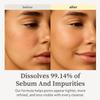 NOONI Korean Cleansing Oil - Snow Aqua 0 LHA Toning Cleansing Oil *2ea | Makeup Blackhead Remover, Pore Control, Glass Skin, Help Control Sebum, Revitalizing, Preppy Stuff, 6.76 Fl Oz x 2 view 3