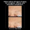 Allies of Skin Retinal 0.1% Peptides Repair Night Cream with 0.1% Encapsulated Retinal, 6 Peptides, 2% Ornithine & EGCG Complex, 8.7% Ceramides & Omegas Complex view 3