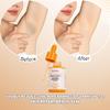 Kojic Underarm Brightening Serum with Niacinamide for Elbows, Knees, Private Areas, Armpit, Dark Spots Corrector Nourishing Firming Daily Skin Care Serum Paraben-Free, Vegan view 2