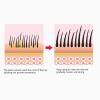 Hair Oil Applicator Scalp Massager, Scalp Oil Applicator with Comb Massage Function 15ml Transparent Serum Dispenser Versatile Hair Oil Tool Scalp Care Solution for Home and view 3