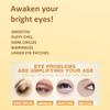 375 Pairs Bulk Gel Eye Masks for Professional Salon & Spa | Revitalizing Under Eye Patches for Puffy Eyes, Dark Circles, Wrinkles view 2