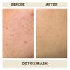 AziMD Skincare Detoxifying Face Mask with 10% Sulfur, Kaolin Clay, Charcoal for Acne, Rosacea Prone Skin, 3 oz view 2