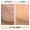 AziMD Skincare Detoxifying Face Mask with 10% Sulfur, Kaolin Clay, Charcoal for Acne, Rosacea Prone Skin, 3 oz view 3
