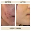 AziMD Skincare Detoxifying Face Mask with 10% Sulfur, Kaolin Clay, Charcoal for Acne, Rosacea Prone Skin, 3 oz view 4