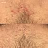 AziMD Skincare The One Spray for Breakouts | Kills Acne-Causing Bacteria & Exfoliates for Smoother, Even-Toned Skin | Targets Body Acne, Scalp Psoriasis, Keratosis Pilaris & More | For Body Use Only view 4