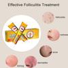 Folliculitis Cream, Folliculitis Treatment, Effective Treatment for Folliculitis Scalp Face and Body, Redness, Inflammation, Ache, Burning, 1.42Oz view 3