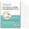 guiyal Pimple Emergency Acne Patches with Plant Essential Oil, Pimple Patches for Nose, Hydrocolloid Acne Patches,Pimple Lnvisible Patches for Face,Large size(7 Pieces) view 1