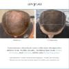 Avjou Researche Scalp Serum  Thicker, Fuller-Looking Hair + Targets Visible Signs of Premature Greying  3 Patented Ingredients  Backed by Cosmetic Science  Oil-Free, All Hair Types, 1.7 oz view 3