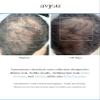 Avjou Researche Scalp Serum  Thicker, Fuller-Looking Hair + Targets Visible Signs of Premature Greying  3 Patented Ingredients  Backed by Cosmetic Science  Oil-Free, All Hair Types, 1.7 oz view 4