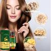 Ginger Anti Hair Loss 7 Days Oil 35ml, Essential Oil, Hair Oil, Natural Ginger Hair (3pcs) view 3