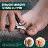 FVION Ingrown Toenail Tools Kit 5 Pcs, Toenail Clippers for Thick & Ingrown Nails, Ingrown Toenail Removal Correction Nail Clippers, Nail File Lifter, Professional Manicure Pedicure Tools view 2