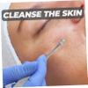 Baluue Professional Pimple Tool Acne Extraction Kit Tool for Whiteheads Blackheads view 3