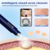 Visual Blackhead Remover Tools with Camera,Pimple Popper Extractor Tool Kit with Camera 20X 1080P Pore Cleaner Acne Comedone Whitehead Extractor Kit for iPhone/Android (Blue) view 3