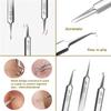 Blackhead Remover,Professional Facial Blackhead Remover Tweezers, Facial Black Head Remover Set,Stainless Steel Blackhead Tweezers Professional Tool Set (02) view 3