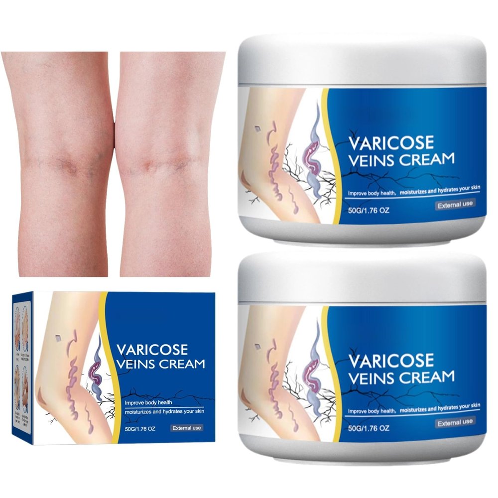 Varicose Veins Treatment for Legs, Spider Varicose Veins Relief Cream, Skin Cream for Legs 50g/1.76fl.oz (2)