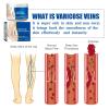 Varicose Veins Treatment for Legs, Spider Varicose Veins Relief Cream, Skin Cream for Legs 50g/1.76fl.oz (2) view 3