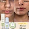 NUUTJOB Under Eye Gel for Dark Circles Puffiness Fine Lines Wrinkles Anti Aging Eye Cream with Vitamin E Black Tea Snail Mucin Mulberry Extract Hydrating Formula  1.01 fl oz view 3